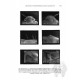 Lis J. A., 2000: A revision of the burrower-bug genus Macroscytus Fieber, 1860 (Hemiptera: Heteroptera: Cydnidae)